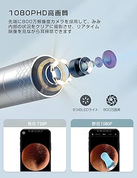 Amazon.co.jp: 耳かきカメラ BEBIRD® X17 Pro 耳鏡 イヤー